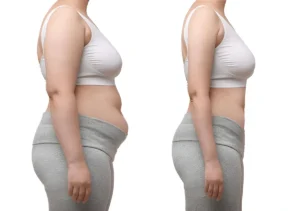 Visual representation of the weight loss process in a woman using compounded oral tirzepatide.